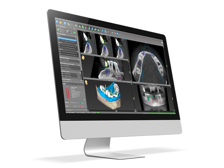 コンピューター上でのシュミレーション