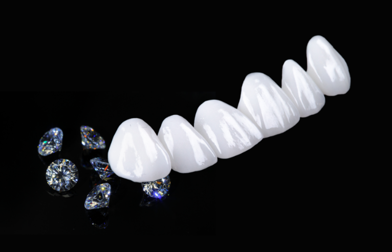 メタルフリー治療金属アレルギーのない長持ちする治療