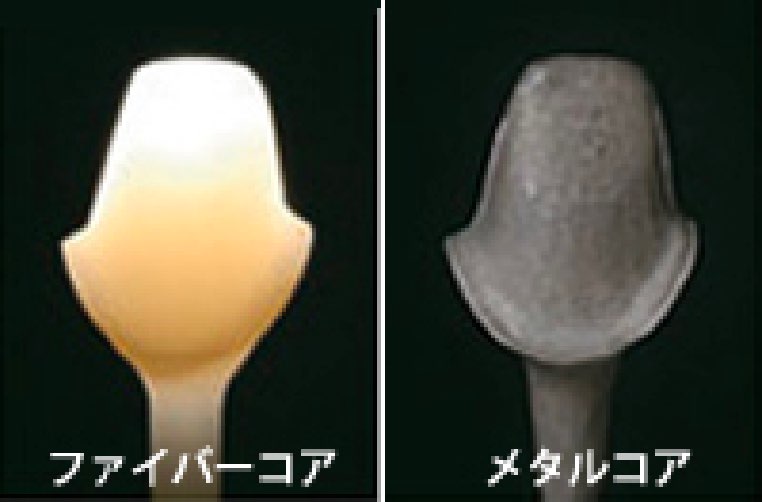 ファイバーコア