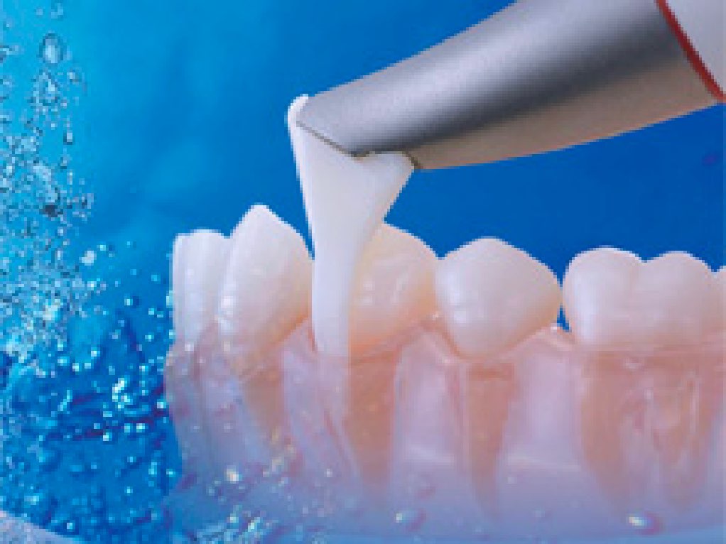 EMSエアフローマスター