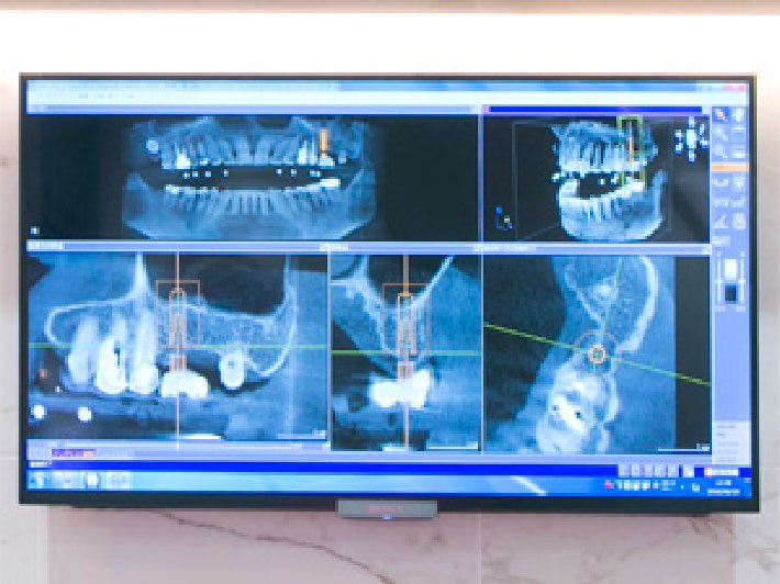 03｜難症例にも対応します