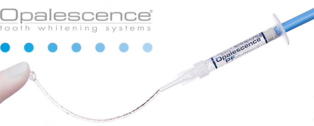 気になる歯の黄ばみやくすみをホワイトニングで解消！