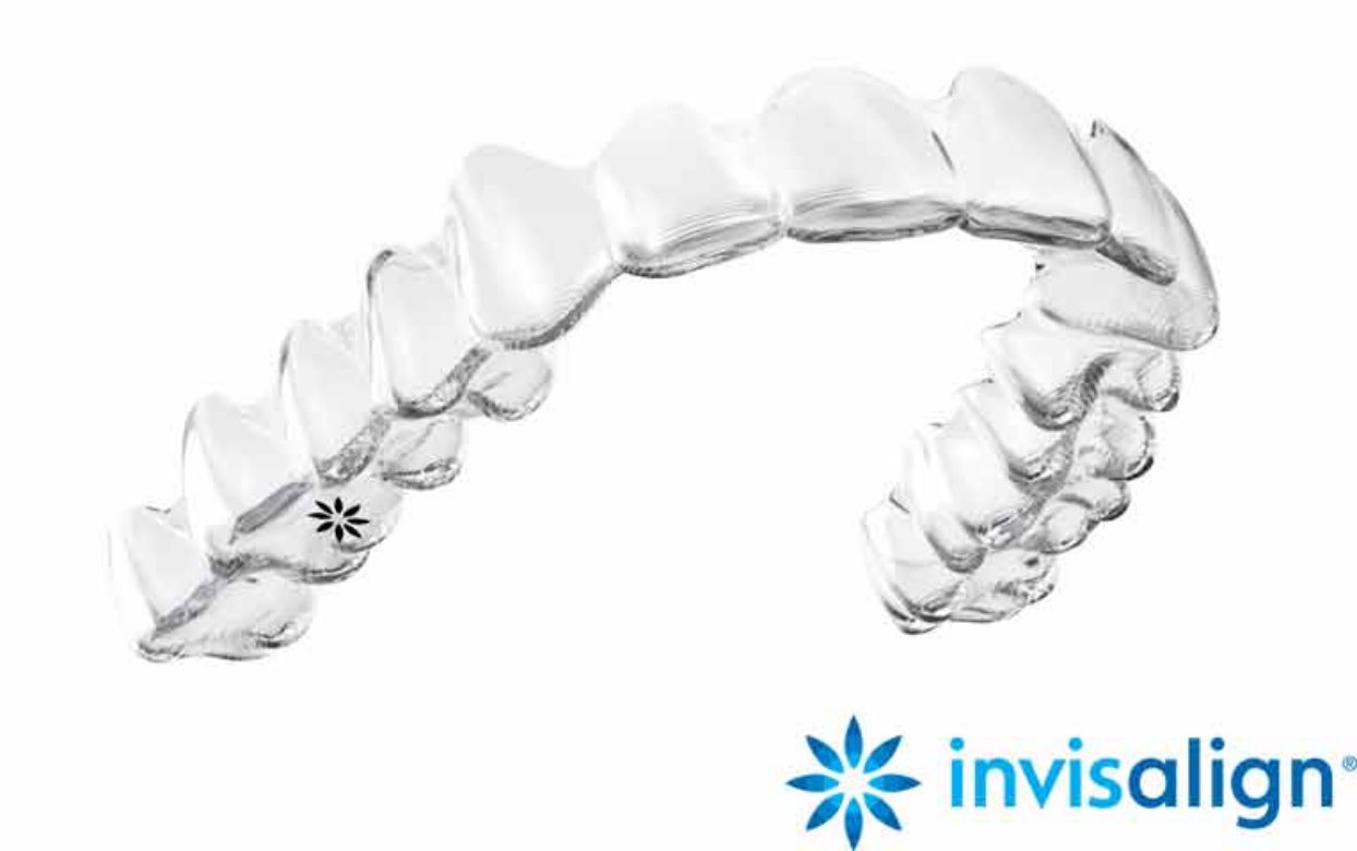 インビザライン