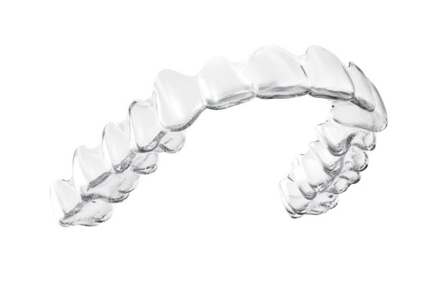 STEP5｜経過観察