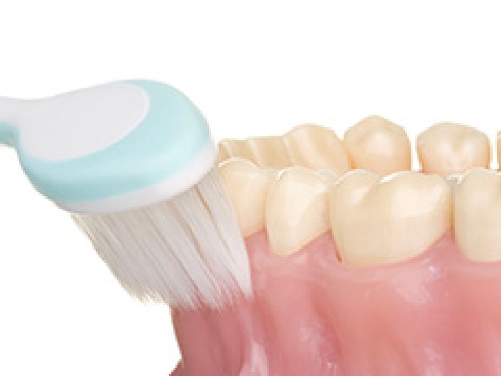 TBI（ブラッシング指導）