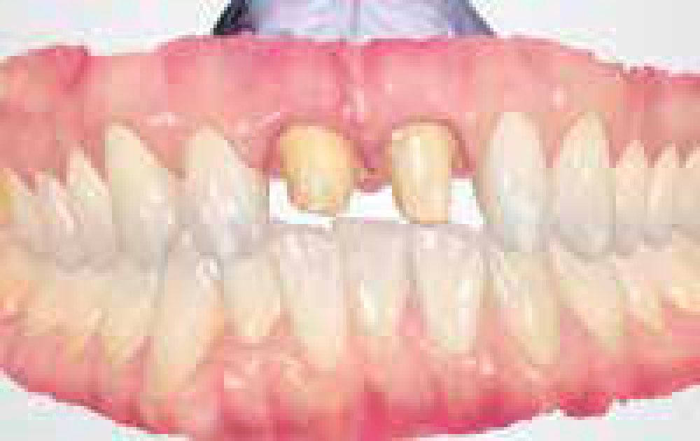 2｜3D撮影によりリアルな光学印象が可能に