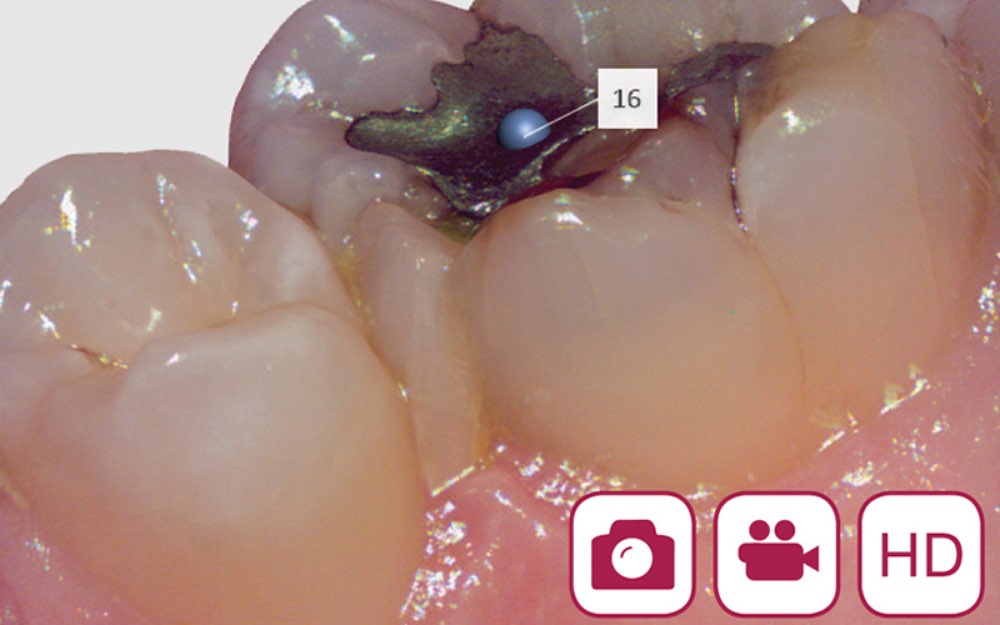 4｜動画と静止画による精密なデータ取得